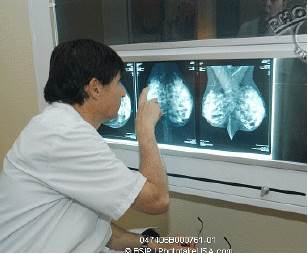 Advances in breast cancer research Advances in breast cancer research