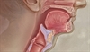 A broad assessment of symptoms revealed an atypical presentation