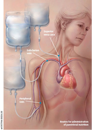renal answers dialysis center bulacan