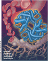 Using ESAs in patients with cancer-related anemia