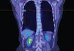 Assay can predict survival Assay can predict survival