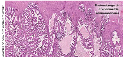 septilin during breastfeeding