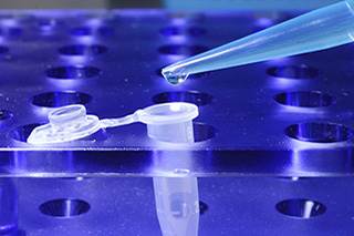 Prognostic test modifies treatment decisions for prostate cancer patient Prognostic test modifies treatment decisions for prostate cancer patient