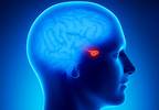 A review of radiotherapy-induced hypopituitarism A review of radiotherapy-induced hypopituitarism