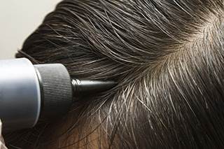 Hair dye use during chemotherapy Hair dye use during chemotherapy