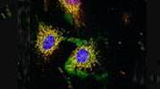 Survival rates lower among African Americans with colon cancer Survival rates lower among African Americans with colon cancer