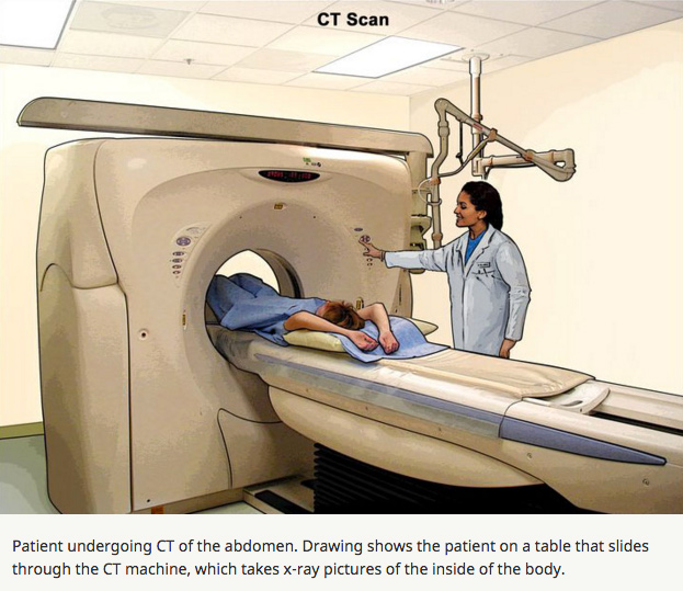 Computed Tomography Ct Scans And Cancer Fact Sheet Ona 8741