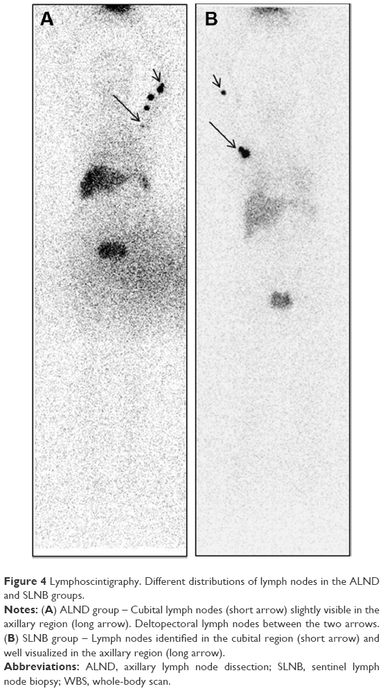 Arm Lymphoscintigraphy After Axillary Lymph Node Dissection or Sentinel