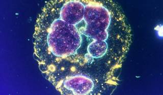 New cancer therapies in 2009: A review for the oncology nurse New cancer therapies in 2009: A review for the oncology nurse
