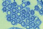 Preventing an H1N1 influenza outbreak among cancer patients: One center's success Preventing an H1N1 influenza outbreak among cancer patients: One center's success