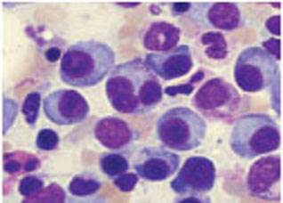 Immediate zoledronic acid treatment better than delayed in women receiving letrozole Immediate zoledronic acid treatment better than delayed in women receiving letrozole