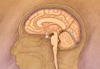Neoplastic meningitis: Keeping palliative care options open Neoplastic meningitis: Keeping palliative care options open