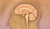 Neoplastic meningitis: Keeping palliative care options open Neoplastic meningitis: Keeping palliative care options open