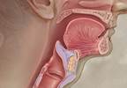 A broad assessment of symptoms revealed an atypical presentation A broad assessment of symptoms revealed an atypical presentation
