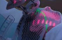 Radiation therapy: What it is and how it works Radiation therapy: What it is and how it works