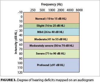 Understanding ototoxicity risks for pediatric oncology patients - ONA