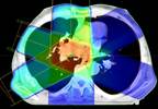 Experts discuss their predictions for radiation medicine Experts discuss their predictions for radiation medicine