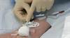 Troubleshooting complications of vascular access devices Troubleshooting complications of vascular access devices