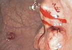 A new era in management of
gastrointestinal cancers A new era in management of
gastrointestinal cancers