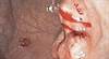 A new era in management of
gastrointestinal cancers A new era in management of
gastrointestinal cancers
