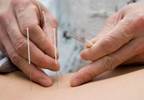 Exploring holistic medicine: Using acupuncture to relieve cancer-related fatigue Exploring holistic medicine: Using acupuncture to relieve cancer-related fatigue