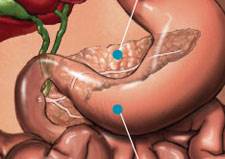 How would I know if I may have pancreatic cancer? How would I know if I may have pancreatic cancer?
