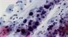 Current and emerging cervical cancer screening guidelines and tools Current and emerging cervical cancer screening guidelines and tools