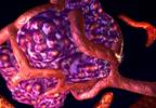 VEGF blockade: Optimizing chemotherapy drug uptake VEGF blockade: Optimizing chemotherapy drug uptake