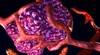 VEGF blockade: Optimizing chemotherapy drug uptake VEGF blockade: Optimizing chemotherapy drug uptake