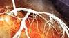 Radiosensitivity: A new focus on cardiovascular sequelae Radiosensitivity: A new focus on cardiovascular sequelae