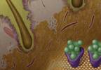 New patterns of dermatologic toxicity with radiation and EGFR blockade New patterns of dermatologic toxicity with radiation and EGFR blockade