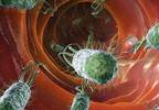 Assessing and treating
radiotherapy-associated
diarrhea Assessing and treating
radiotherapy-associated
diarrhea