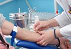 Inclusion of creatinine in blood work during carboplatin treatment Inclusion of creatinine in blood work during carboplatin treatment
