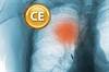 Non-small cell lung cancer: Molecular targets and
emerging options for care Non-small cell lung cancer: Molecular targets and
emerging options for care