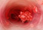 Bevacizumab use and thromboembolic events Bevacizumab use and thromboembolic events