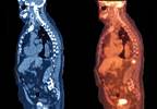 'Index patients' aid mCRPC guideline 'Index patients' aid mCRPC guideline