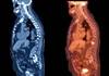 'Index patients' aid mCRPC guideline 'Index patients' aid mCRPC guideline