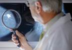 Bisphosphonate use may not prevent breast cancer Bisphosphonate use may not prevent breast cancer