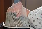 Improved Outcomes in Lung Cancer With Hyperfractionated Chemoradiation Therapy Improved Outcomes in Lung Cancer With Hyperfractionated Chemoradiation Therapy