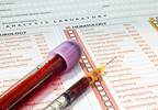 Lab tests for anemic patients Lab tests for anemic patients