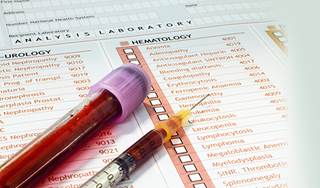 In a study, end-stage renal disease was 31% more likely to develop in CKD patients with versus without anemia. In a study, end-stage renal disease was 31% more likely to develop in CKD patients with versus without anemia.