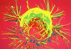 Estrogen enhancers tied to aggressive breast cancer Estrogen enhancers tied to aggressive breast cancer