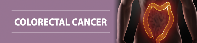 Colorectal Cancer section