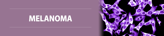 Melanoma Cancer section