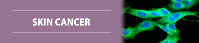 Skin Cancer section