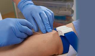 Rapid infusion of second dose rituximab appears safe Rapid infusion of second dose rituximab appears safe