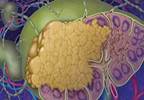 Study Identifies Factors Influencing Advanced Follicular Lymphoma Outcomes Study Identifies Factors Influencing Advanced Follicular Lymphoma Outcomes