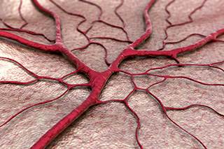 Angiogenesis Inhibitors (Fact Sheet) Angiogenesis Inhibitors (Fact Sheet)