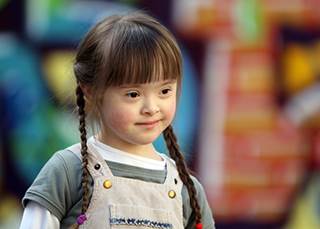 Down Syndrome–Leukemia Link Identified Down Syndrome–Leukemia Link Identified
