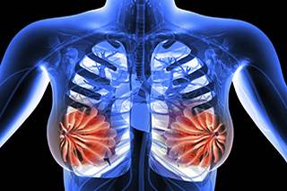 Double mastectomy halves death risk for women with BRCA-related breast cancer Double mastectomy halves death risk for women with BRCA-related breast cancer
